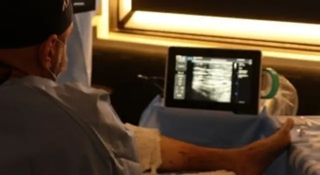 Ultrassom com Doppler para diagnóstico vascular
